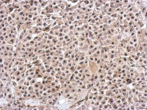 KIAA0020 Antibody in Immunohistochemistry (Paraffin) (IHC (P))