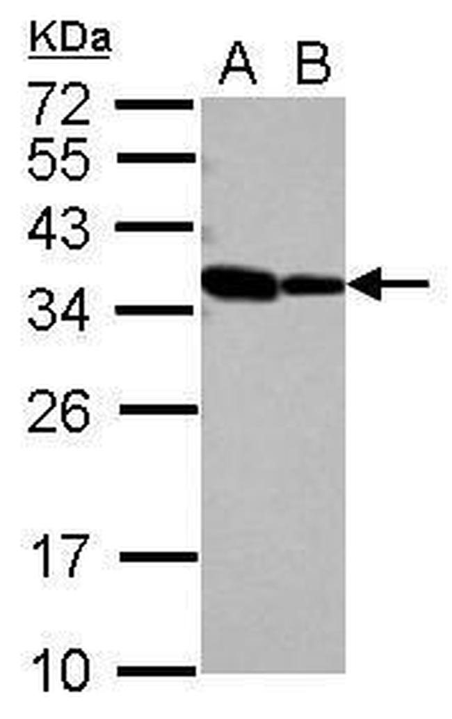 RBM11 Antibody in Western Blot (WB)