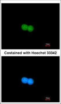 MRE11 Antibody in Immunocytochemistry (ICC/IF)