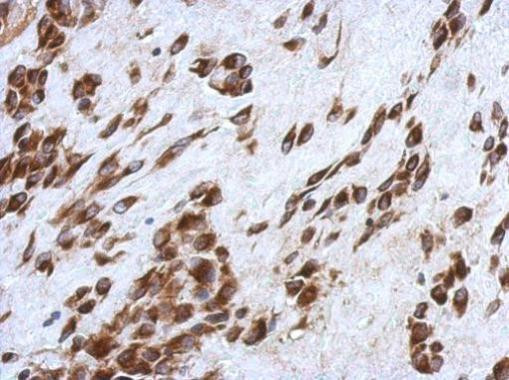 CCDC44 Antibody in Immunohistochemistry (Paraffin) (IHC (P))