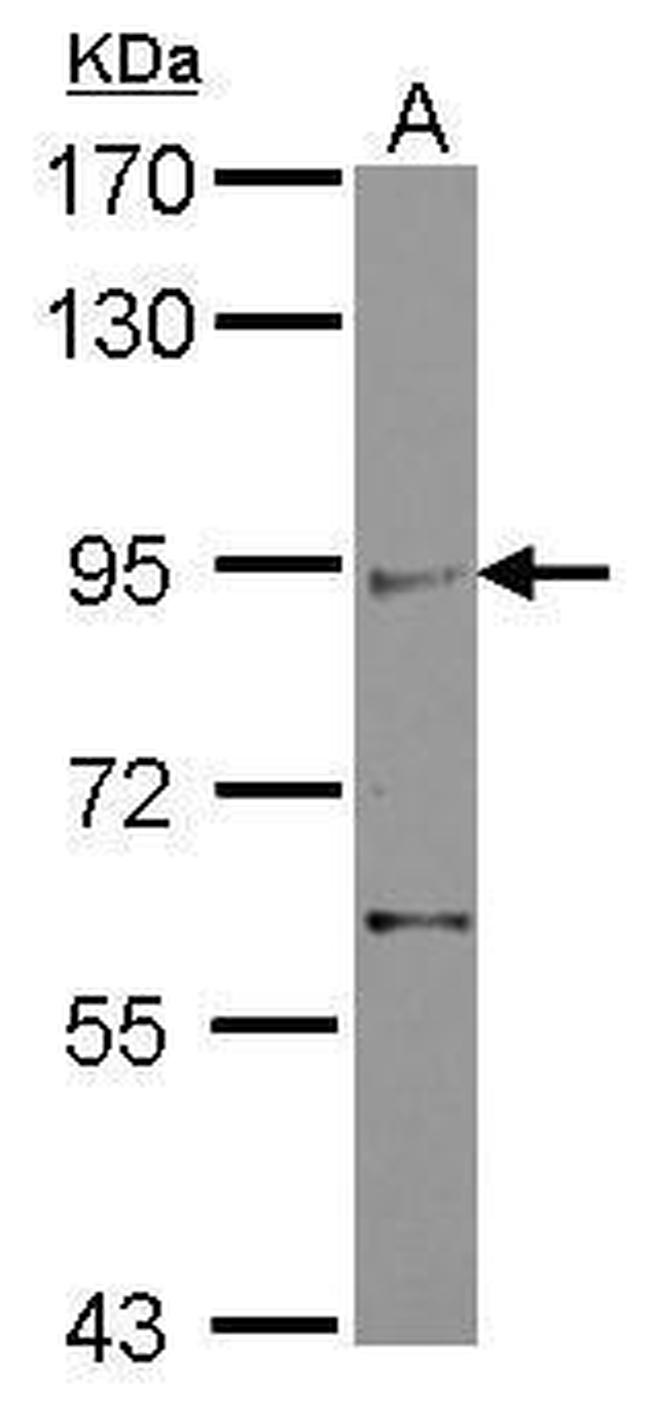 ZMIZ2 Antibody in Western Blot (WB)