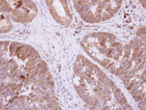 DIS3L2 Antibody in Immunohistochemistry (Paraffin) (IHC (P))