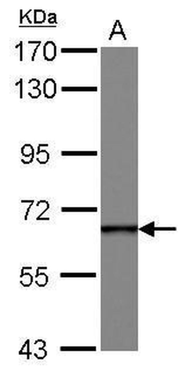 DDX49 Antibody in Western Blot (WB)