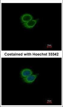 Synaptotagmin 6 Antibody in Immunocytochemistry (ICC/IF)