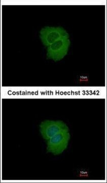 TRIM10 Antibody in Immunocytochemistry (ICC/IF)