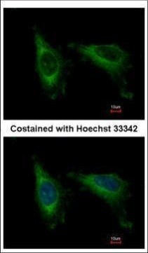 Cdc37L1 Antibody in Immunocytochemistry (ICC/IF)