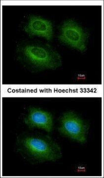 PDE10A Antibody in Immunocytochemistry (ICC/IF)