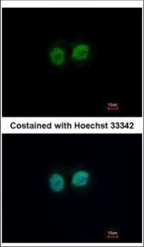 RCC2 Antibody in Immunocytochemistry (ICC/IF)