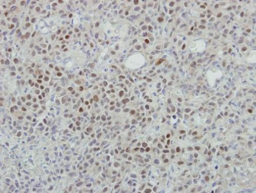 MINA53 Antibody in Immunohistochemistry (Paraffin) (IHC (P))