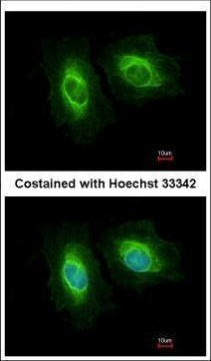 SASS6 Antibody in Immunocytochemistry (ICC/IF)