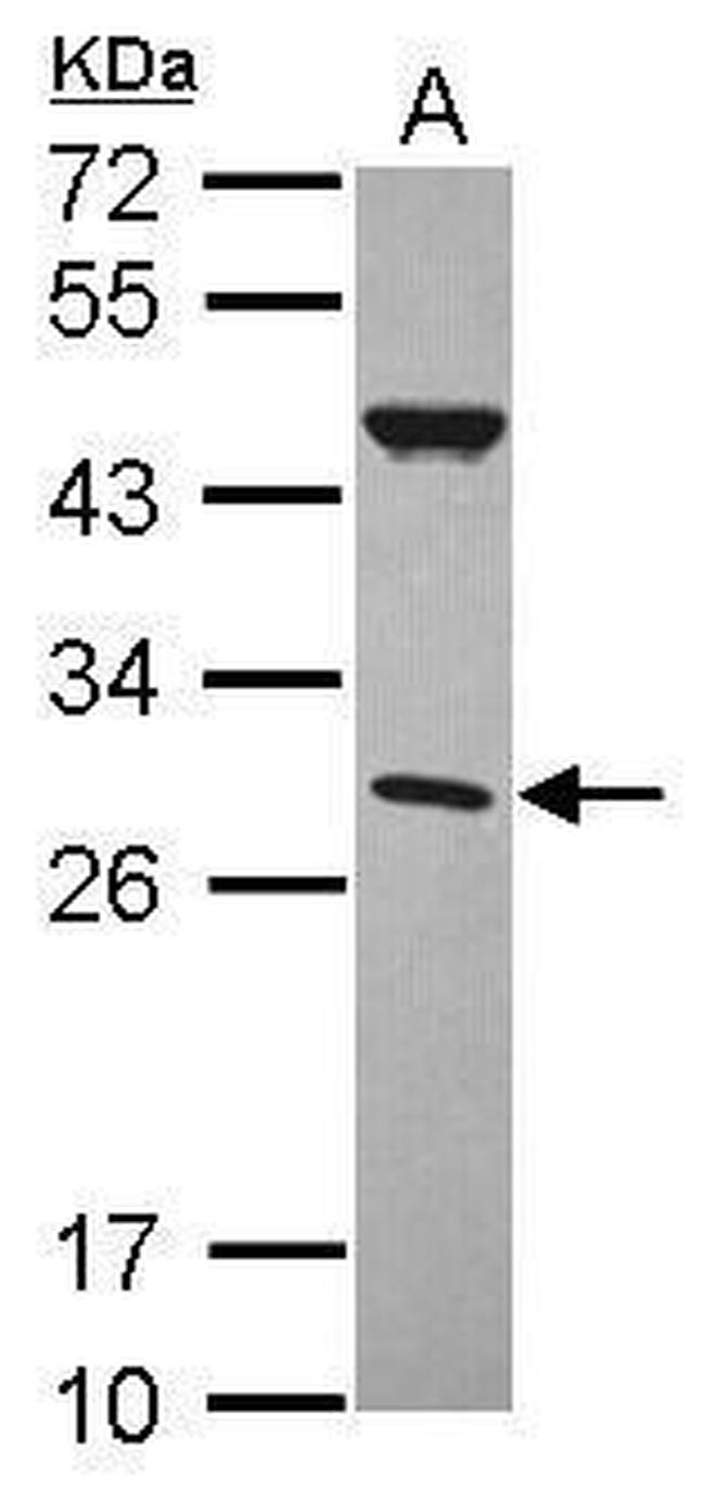CFHR2 Antibody in Western Blot (WB)
