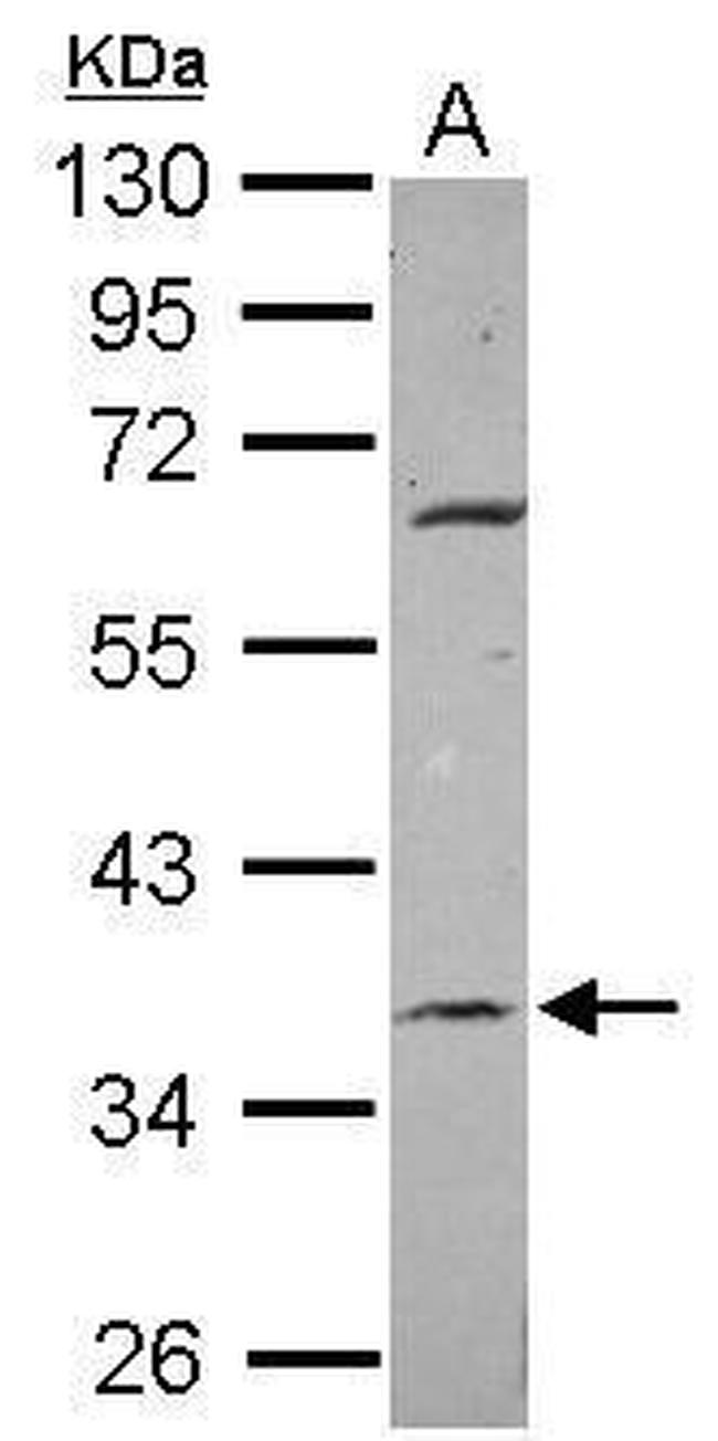 METTL2B Antibody in Western Blot (WB)