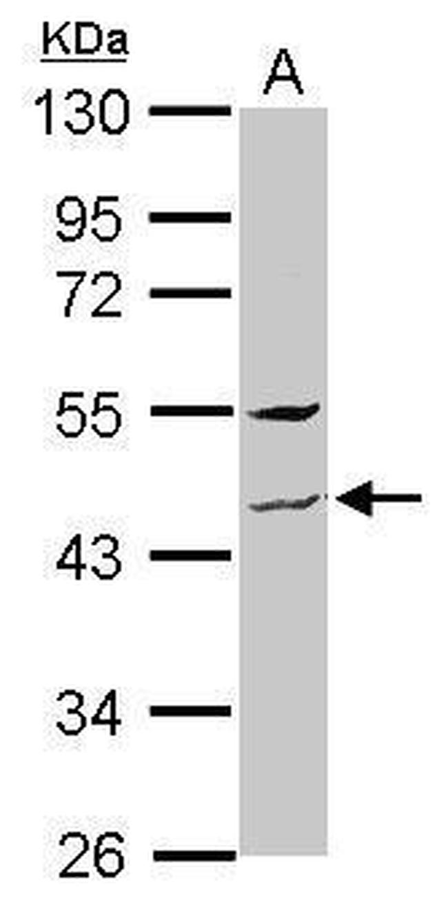 ZNF514 Antibody in Western Blot (WB)