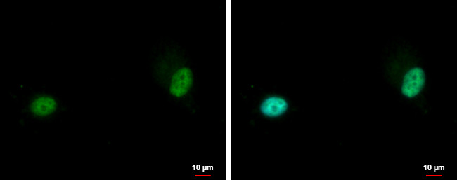 ZNF567 Antibody in Immunocytochemistry (ICC/IF)