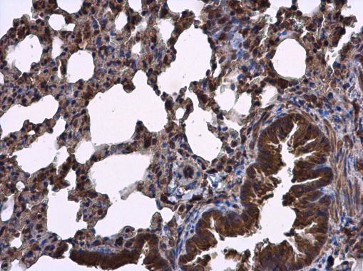 RIPX Antibody in Immunohistochemistry (Paraffin) (IHC (P))