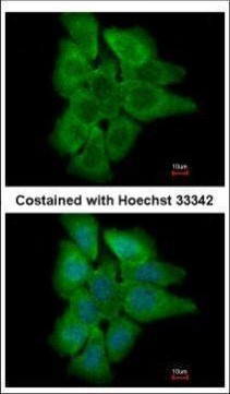 PHLPP2 Antibody in Immunocytochemistry (ICC/IF)