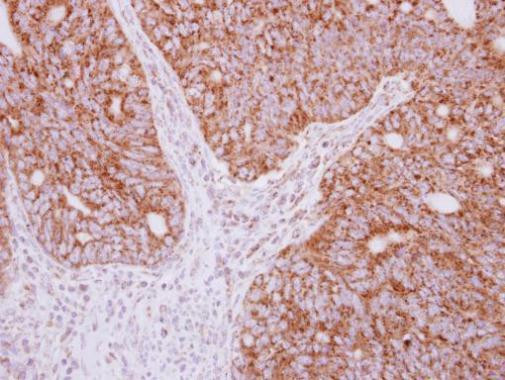 YARS2 Antibody in Immunohistochemistry (Paraffin) (IHC (P))