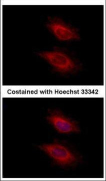 YARS2 Antibody in Immunocytochemistry (ICC/IF)