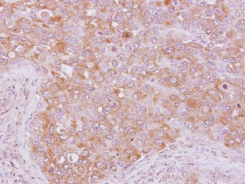ARHGAP5 Antibody in Immunohistochemistry (Paraffin) (IHC (P))