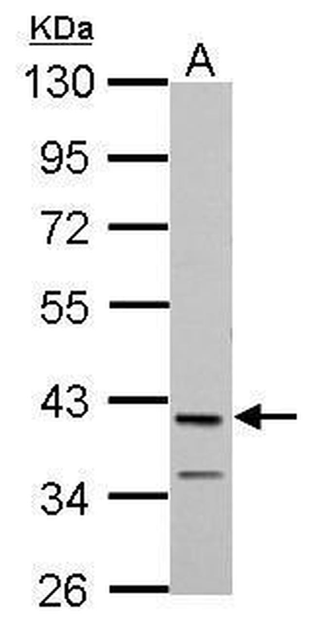 MAB21L1 Antibody in Western Blot (WB)