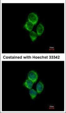 SLC22A18AS Antibody in Immunocytochemistry (ICC/IF)