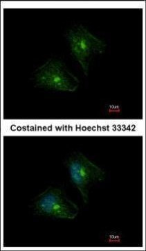 PTPRH Antibody in Immunocytochemistry (ICC/IF)