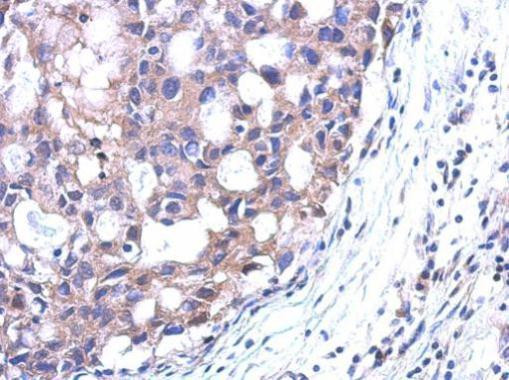 SRM Antibody in Immunohistochemistry (Paraffin) (IHC (P))