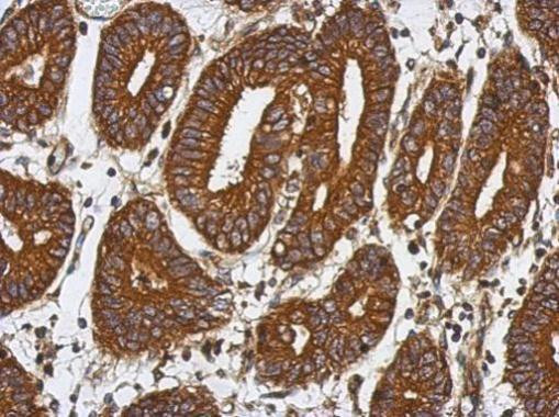 BAT5 Antibody in Immunohistochemistry (Paraffin) (IHC (P))