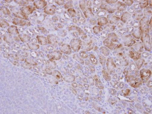 CALM Antibody in Immunohistochemistry (Paraffin) (IHC (P))