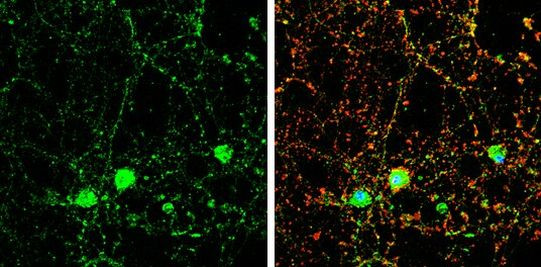 DOC2A Antibody in Immunocytochemistry (ICC/IF)