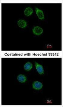 CHST2 Antibody in Immunocytochemistry (ICC/IF)