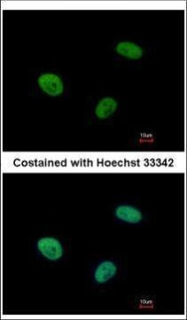 UBE3C Antibody in Immunocytochemistry (ICC/IF)