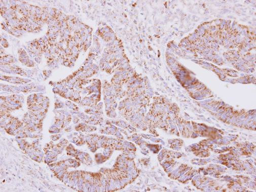 ST6GALNAC2 Antibody in Immunohistochemistry (Paraffin) (IHC (P))