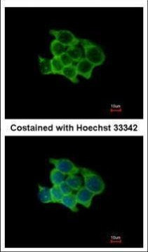 POFUT1 Antibody in Immunocytochemistry (ICC/IF)