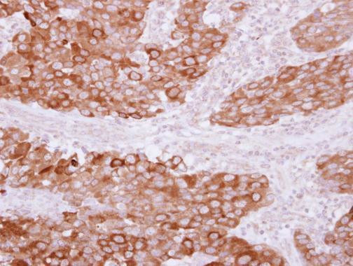 PITPNB Antibody in Immunohistochemistry (Paraffin) (IHC (P))