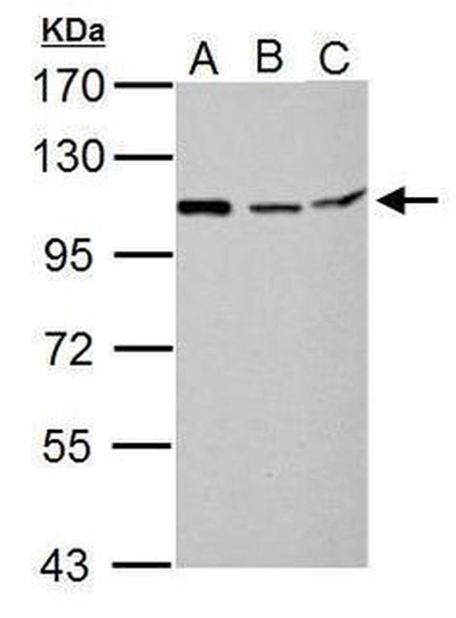 MTHFD1L Antibody in Western Blot (WB)