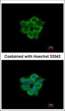 ACOT11 Antibody in Immunocytochemistry (ICC/IF)