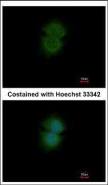 TBL2 Antibody in Immunocytochemistry (ICC/IF)