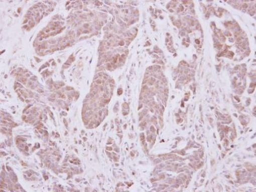 VPS41 Antibody in Immunohistochemistry (Paraffin) (IHC (P))