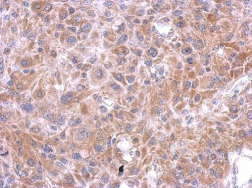 SPOCK3 Antibody in Immunohistochemistry (Paraffin) (IHC (P))