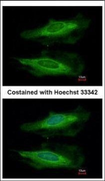 HECA Antibody in Immunocytochemistry (ICC/IF)