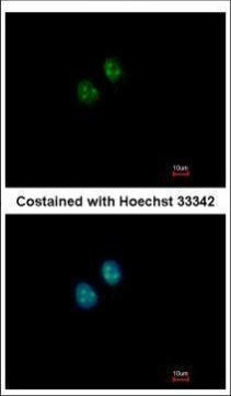NAT10 Antibody in Immunocytochemistry (ICC/IF)