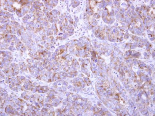 FBXL8 Antibody in Immunohistochemistry (Paraffin) (IHC (P))