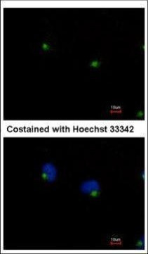 IFT122 Antibody in Immunocytochemistry (ICC/IF)