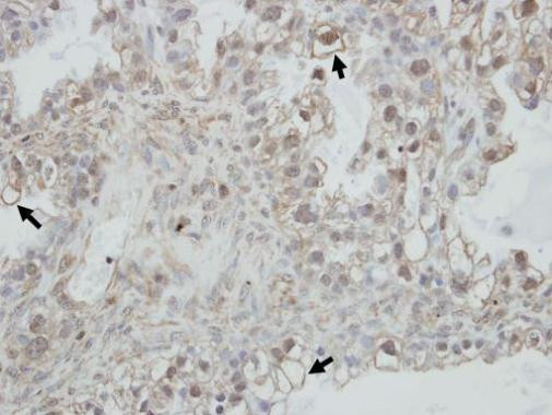 PCDHGC4 Antibody in Immunohistochemistry (Paraffin) (IHC (P))