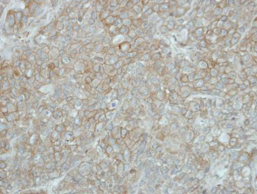 PCDHGB5 Antibody in Immunohistochemistry (Paraffin) (IHC (P))