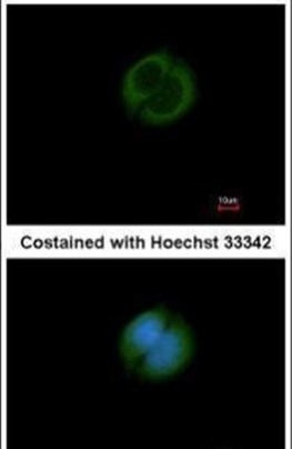 GRAMD1B Antibody in Immunocytochemistry (ICC/IF)