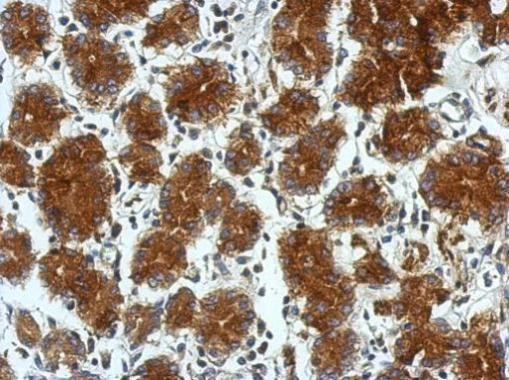 TSCOT Antibody in Immunohistochemistry (Paraffin) (IHC (P))