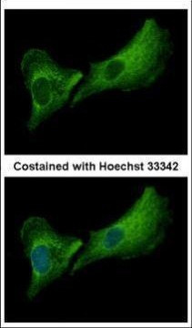 DNASE2B Antibody in Immunocytochemistry (ICC/IF)