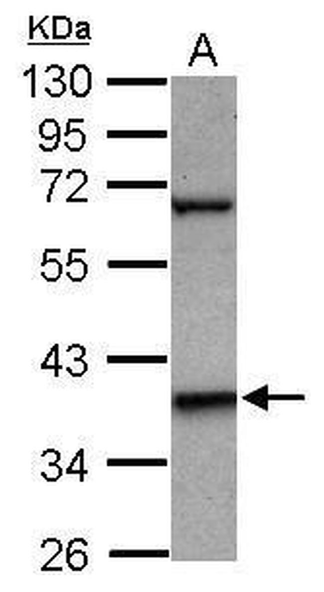 LHX5 Antibody in Western Blot (WB)